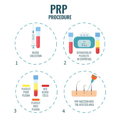 prp therapy and prp treatment