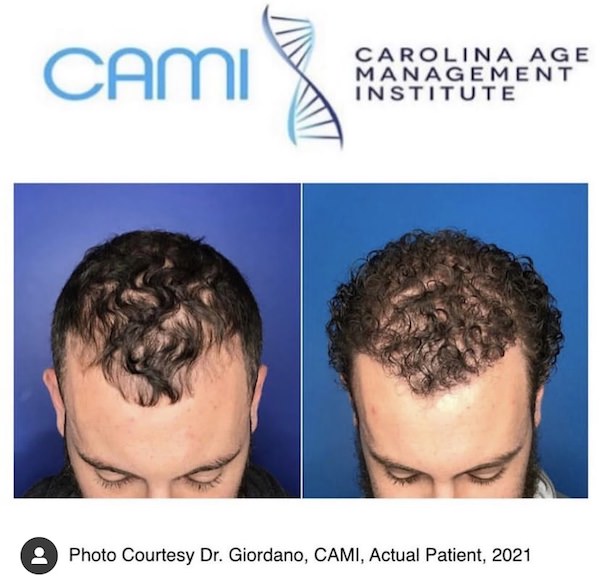 Best Hair Specialist Doctor, Hair Loss Specialist in Charlotte NC