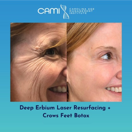 Multi-Modality Stacked Treatments case #72693